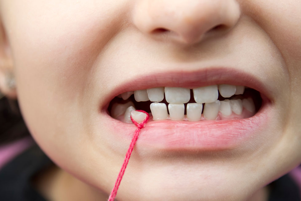 Zähne ziehen – Ist das noch üblich?