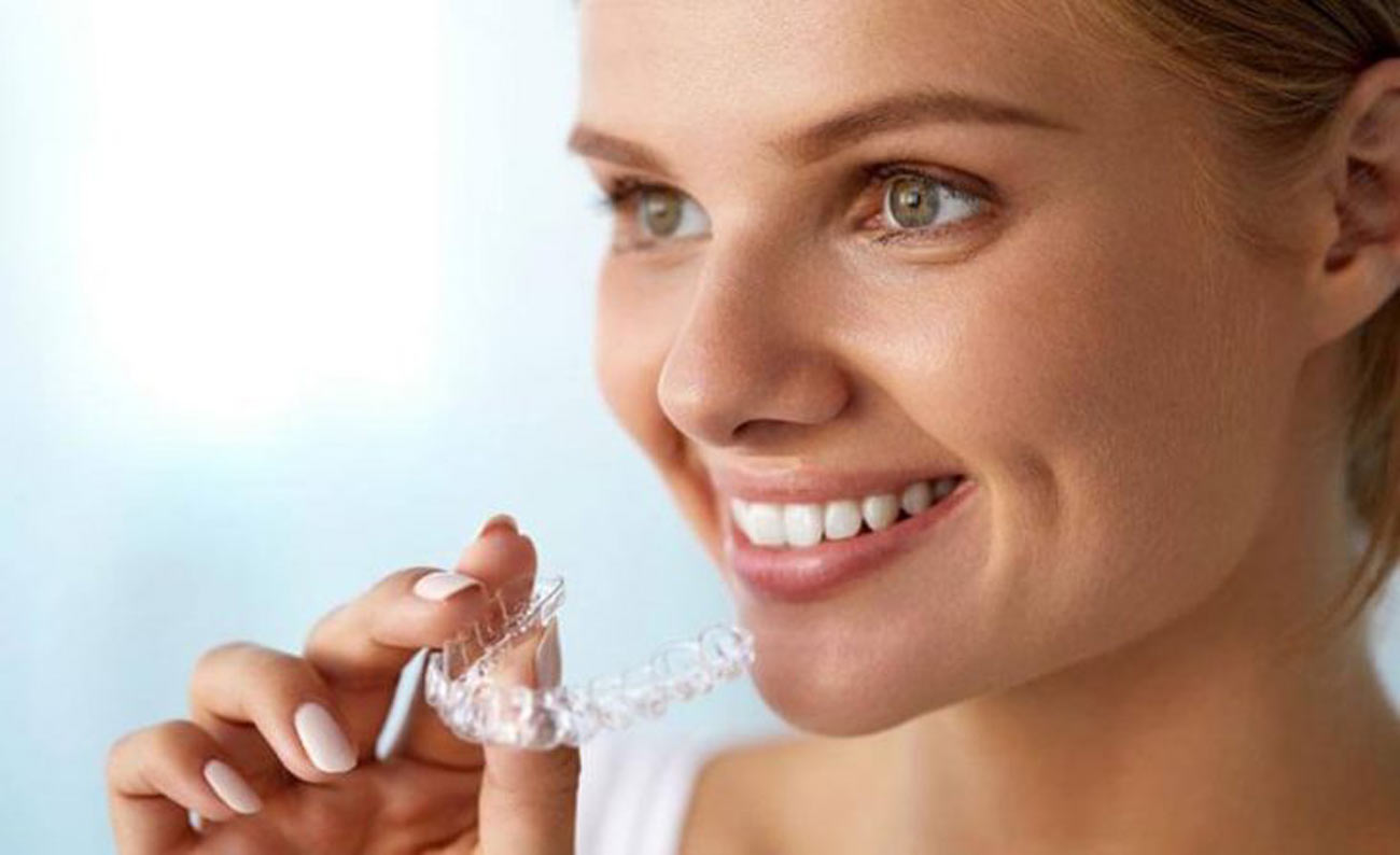 Unsichtbare Zahnkorrektur mit einer Invisalign Schiene